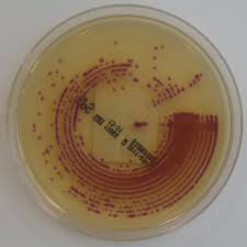 CPE agar