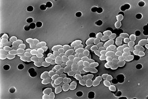 Vancomycin-Resistant_Enterococcus_01